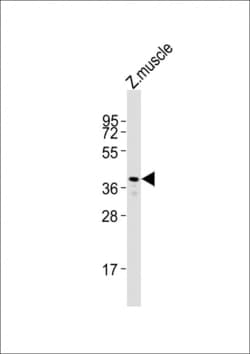 Invitrogen Rhodopsin Polyclonal Antibody 400 &mu;L; Unconjugated:Antibodies,