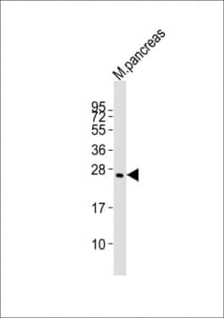 Invitrogen Plet1 Polyclonal Antibody 80 &mu;L; Unconjugated:Antibodies,