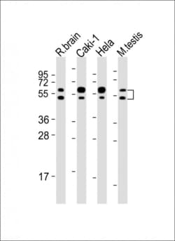 Invitrogen NKIAMRE Polyclonal Antibody 200 &mu;L; Unconjugated:Antibodies,