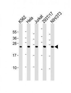 PSMB3 Rabbit anti-Human, Mouse, Polyclonal, Invitrogen 200 &mu;L; Unconjugated:Antibodies,