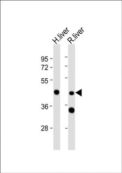 CR16 Rabbit anti-Human, Rat, Polyclonal, Invitrogen 200 &mu;L; Unconjugated:Antibodies,