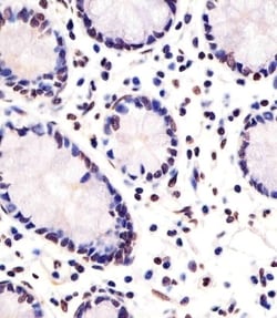Invitrogen FEV Polyclonal Antibody 200 &mu;L; Unconjugated:Antibodies,