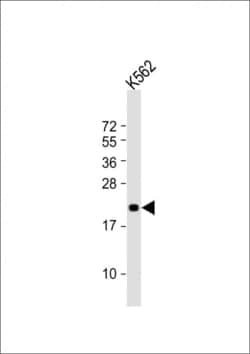 Invitrogen FEV Polyclonal Antibody 200 &mu;L; Unconjugated:Antibodies,