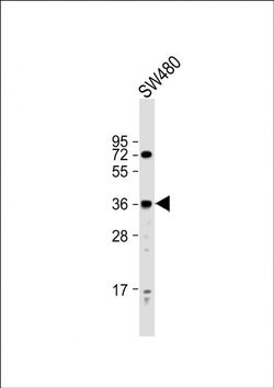 PRSS23 Rabbit anti-Human, Polyclonal, Invitrogen 200 &mu;L; Unconjugated:Antibodies,