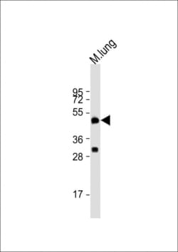 Invitrogen DPEP2 Polyclonal Antibody 200 &mu;L; Unconjugated:Antibodies,