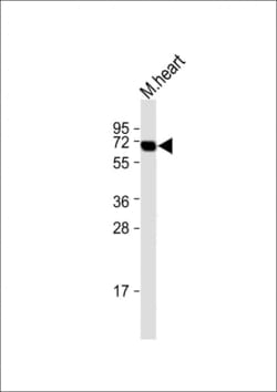 Invitrogen DPEP2 Polyclonal Antibody 200 &mu;L; Unconjugated:Antibodies,