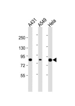 Invitrogen PLA2G4D Polyclonal Antibody 200 &mu;L; Unconjugated:Antibodies,