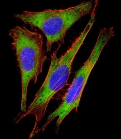 Invitrogen RPS10 Polyclonal Antibody 200 &mu;L; Unconjugated:Antibodies,