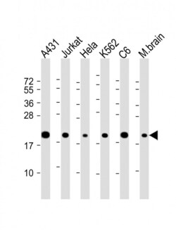 Invitrogen RPS10 Polyclonal Antibody 200 &mu;L; Unconjugated:Antibodies,