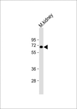 Invitrogen MGAT4A Polyclonal Antibody 200 &mu;L; Unconjugated:Antibodies,