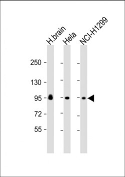 Invitrogen GALC Polyclonal Antibody 200 &mu;L; Unconjugated:Antibodies,