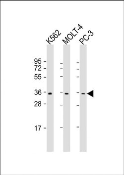 PIGC Rabbit anti-Human, Polyclonal, Invitrogen 200 &mu;L; Unconjugated:Antibodies,