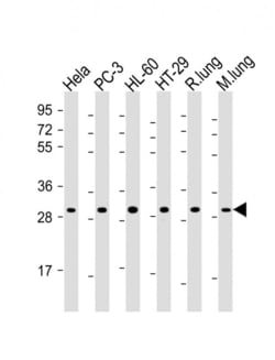 Invitrogen RPS4X Polyclonal Antibody 200 &mu;L; Unconjugated:Antibodies,