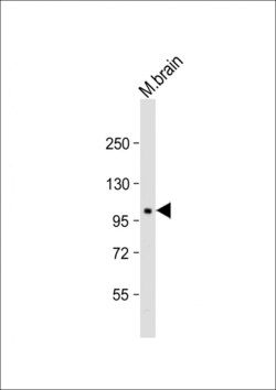 Invitrogen PI4KA Polyclonal Antibody 200 &mu;L; Unconjugated:Antibodies,