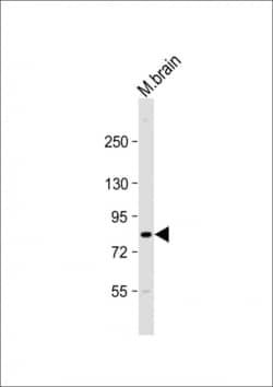 Invitrogen CIP2A Polyclonal Antibody 200 &mu;L; Unconjugated:Antibodies,