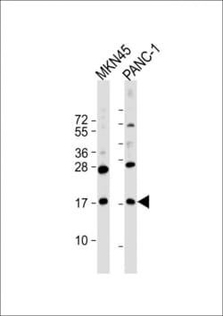 Invitrogen FAM159B Polyclonal Antibody 200 &mu;L; Unconjugated:Antibodies,