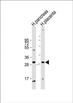 PPP1R3E Rabbit anti-Human, Polyclonal, Invitrogen 200 &mu;L; Unconjugated:Antibodies,