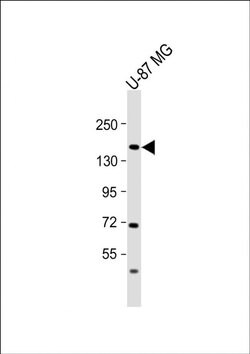 ADAMTS20 Rabbit anti-Human, Polyclonal, Invitrogen 200 &mu;L; Unconjugated:Antibodies,