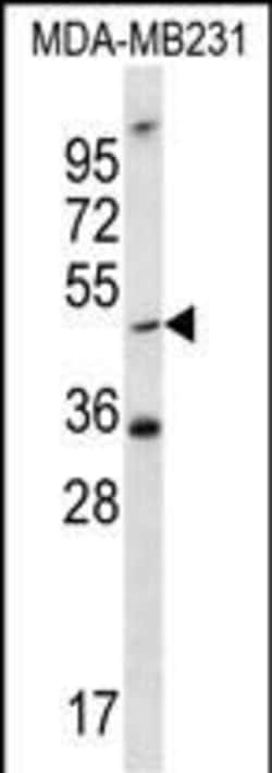 Invitrogen TPST1 Polyclonal Antibody 400 &mu;L; Unconjugated:Antibodies,