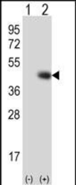 Invitrogen TPST1 Polyclonal Antibody 400 &mu;L; Unconjugated:Antibodies,