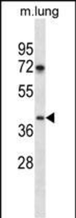 Invitrogen TPST1 Polyclonal Antibody 400 &mu;L; Unconjugated:Antibodies,