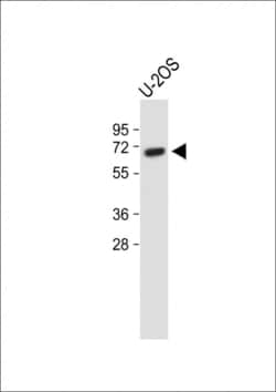 Invitrogen Glypican 4 Polyclonal Antibody 400 &mu;L; Unconjugated:Antibodies,