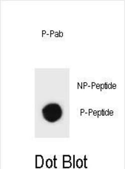 Invitrogen Phospho-TSC1 (Ser312) Polyclonal Antibody 400 &mu;L; Unconjugated:Antibodies,