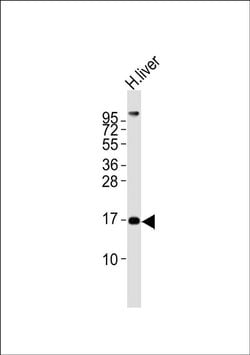 MGST2 Rabbit anti-Human, Mouse, Rat, Polyclonal, Invitrogen 100 &mu;L;