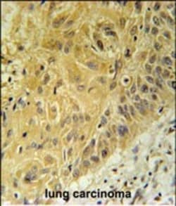 Invitrogen WNT5A Polyclonal Antibody 200 &mu;L; Unconjugated:Antibodies,