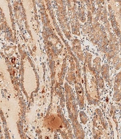 Invitrogen WNT5A Polyclonal Antibody 200 &mu;L; Unconjugated:Antibodies,