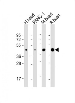 Invitrogen WNT5A Polyclonal Antibody 200 &mu;L; Unconjugated:Antibodies,