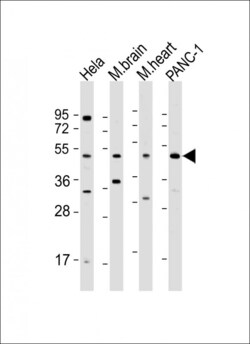 Invitrogen WNT5A Polyclonal Antibody 200 &mu;L; Unconjugated:Antibodies,