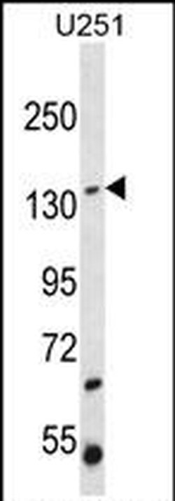 ST5 Rabbit anti-Human, Polyclonal, Invitrogen 400 &mu;L; Unconjugated:Antibodies,