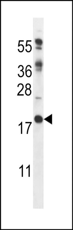 RCAN2 Rabbit anti-Human, Mouse, Polyclonal, Invitrogen 400 &mu;L; Unconjugated:Antibodies,