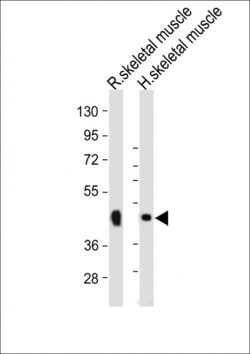 Invitrogen WNT10B Polyclonal Antibody 400 &mu;L | Buy Online | Invitrogen&trade; | Fisher Scientific