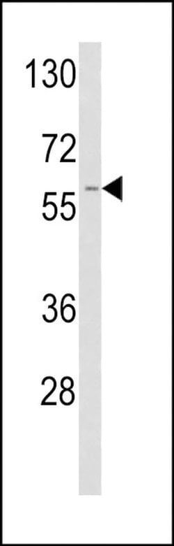 tPA Rabbit anti-Human, Polyclonal, Invitrogen 400 &mu;L; Unconjugated:Antibodies,