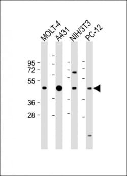 Invitrogen ASS1 Polyclonal Antibody 400 &mu;L; Unconjugated:Antibodies,