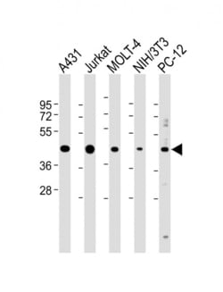 Invitrogen ASS1 Polyclonal Antibody 400 &mu;L; Unconjugated:Antibodies,