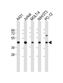 Invitrogen ASS1 Polyclonal Antibody 400 &mu;L; Unconjugated:Antibodies,