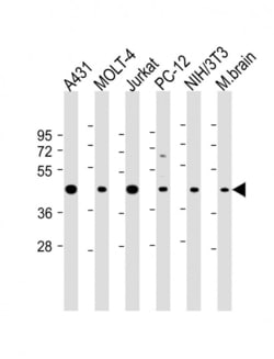 Invitrogen ASS1 Polyclonal Antibody 400 &mu;L; Unconjugated:Antibodies,
