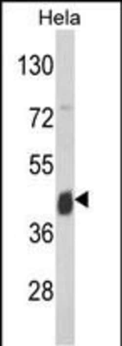 Invitrogen ASS1 Polyclonal Antibody 400 &mu;L; Unconjugated:Antibodies,