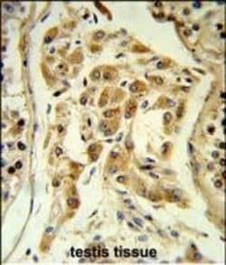 Invitrogen ESPN Polyclonal Antibody 400 &mu;L; Unconjugated:Antibodies,