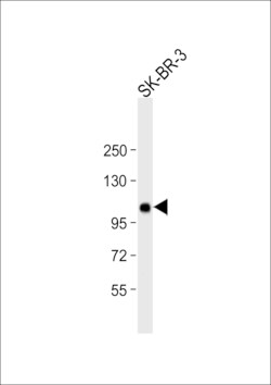 Invitrogen ESPN Polyclonal Antibody 400 &mu;L; Unconjugated:Antibodies,