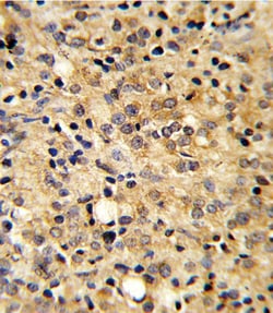 Invitrogen COMP Polyclonal Antibody 400 &mu;L; Unconjugated:Antibodies,