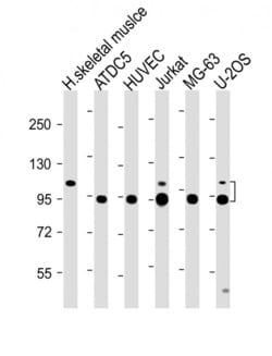 Invitrogen COMP Polyclonal Antibody 400 &mu;L; Unconjugated:Antibodies,