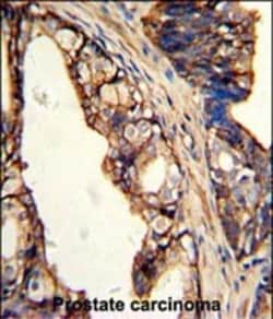 Invitrogen TGM4 Polyclonal Antibody 400 &mu;L; Unconjugated:Antibodies,