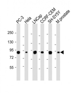 Invitrogen TGM4 Polyclonal Antibody 400 &mu;L; Unconjugated:Antibodies,