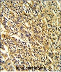 Invitrogen Kir2.1 (KCNJ2) Polyclonal Antibody 400 &mu;L; Unconjugated:Antibodies,