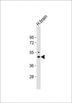 Invitrogen Kir2.1 (KCNJ2) Polyclonal Antibody 400 &mu;L; Unconjugated:Antibodies,