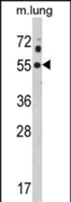 Invitrogen Kir2.1 (KCNJ2) Polyclonal Antibody 400 &mu;L; Unconjugated:Antibodies,
